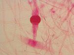 MISSING THUMBNAIL
